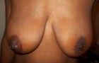 Jamaican tits
