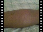 dark skin (leggs & crotch)